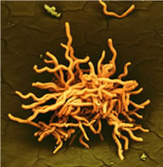  borrelia burgdorferi